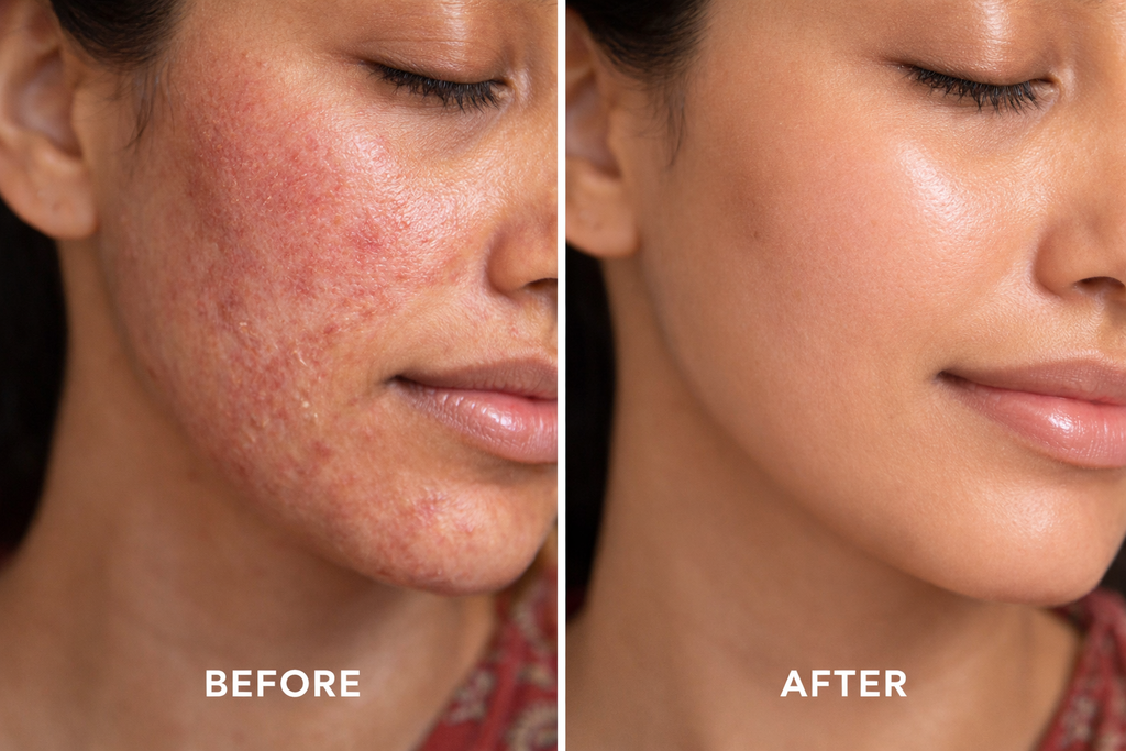 𝗔𝗻𝗰𝗶𝗲𝗻𝘁 𝗔𝘆𝘂𝗿𝘃𝗲𝗱 - Ghee Cream for Skin Repair, Burns, Dryness & Anti-Aging